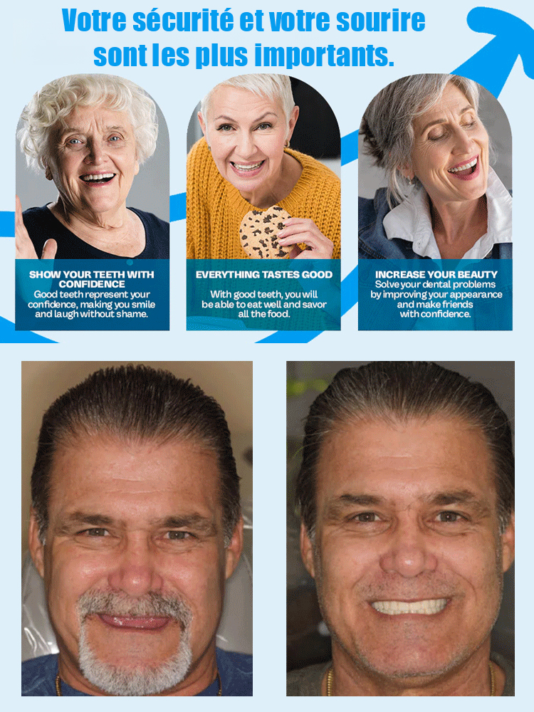 Dentiers de maquillage de scène DIYCOS