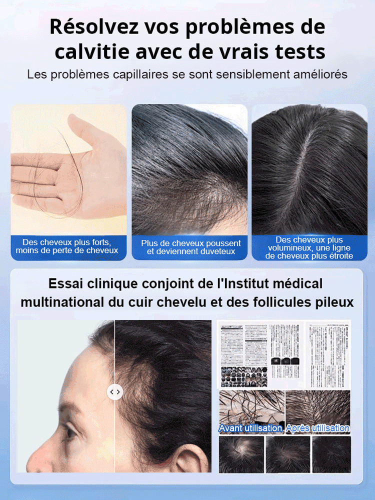 【Vendu en Corée】Ampoule innovante contre la perte de cheveux X