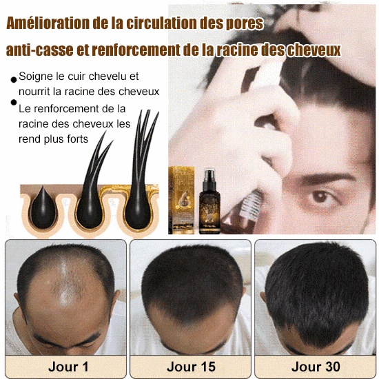 Spray de croissance capillaire à la biotine