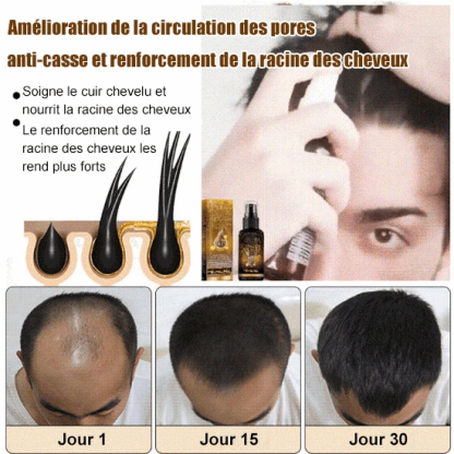 Spray de croissance capillaire à la biotine