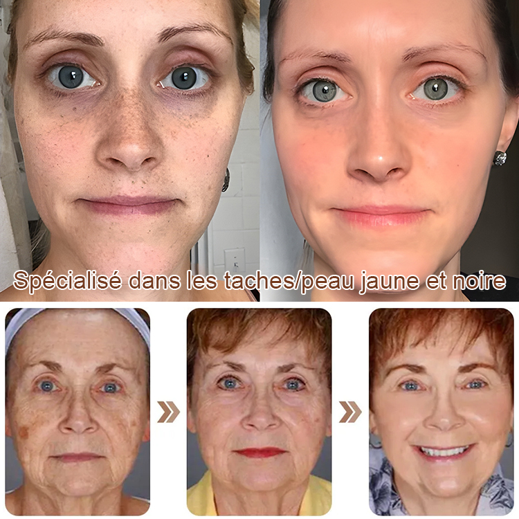 Masque pelable blanchissant pour peau sensible, nettoyage en profondeur sans irritation.