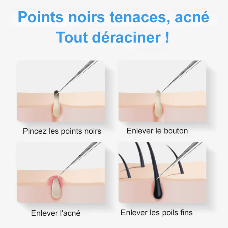 Pince à épiler pour éliminer les points noirs contre l'acné  Ensemble de 3 pièces
