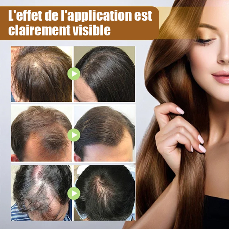 Spray de croissance capillaire à la biotine