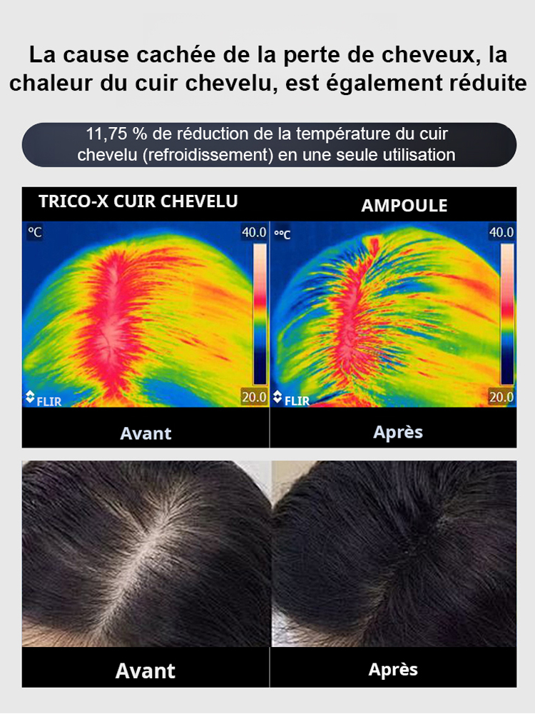 【Vendu en Corée】Ampoule innovante contre la perte de cheveux X