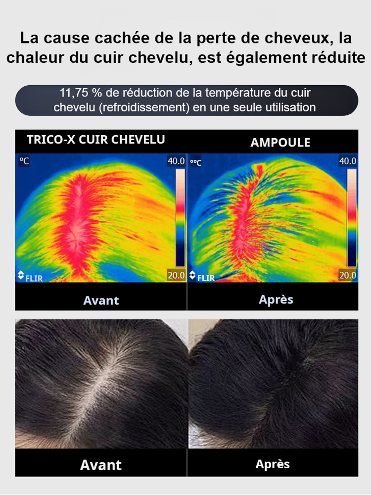 【Vendu en Corée】Ampoule innovante contre la perte de cheveux X