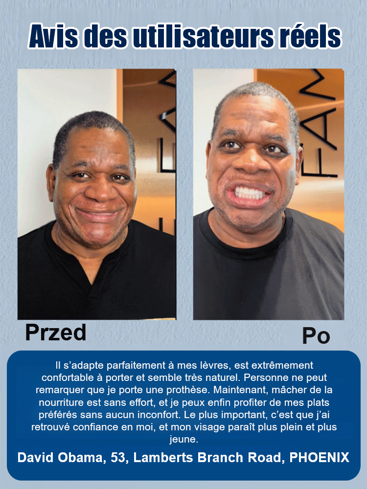 Dentiers de maquillage de scène DIYCOS