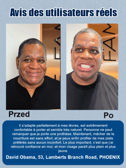 Dentiers de maquillage de scène DIYCOS