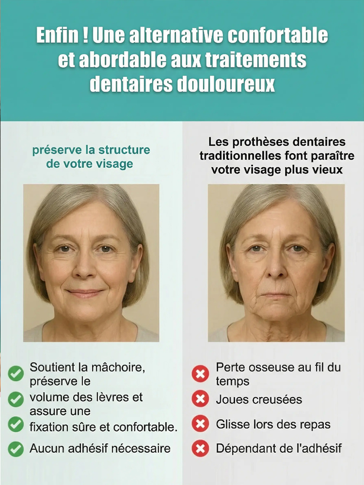 Kit de décoration pour prothèses dentaires à ajustement confortable