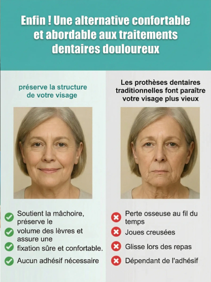 Kit de décoration pour prothèses dentaires à ajustement confortable