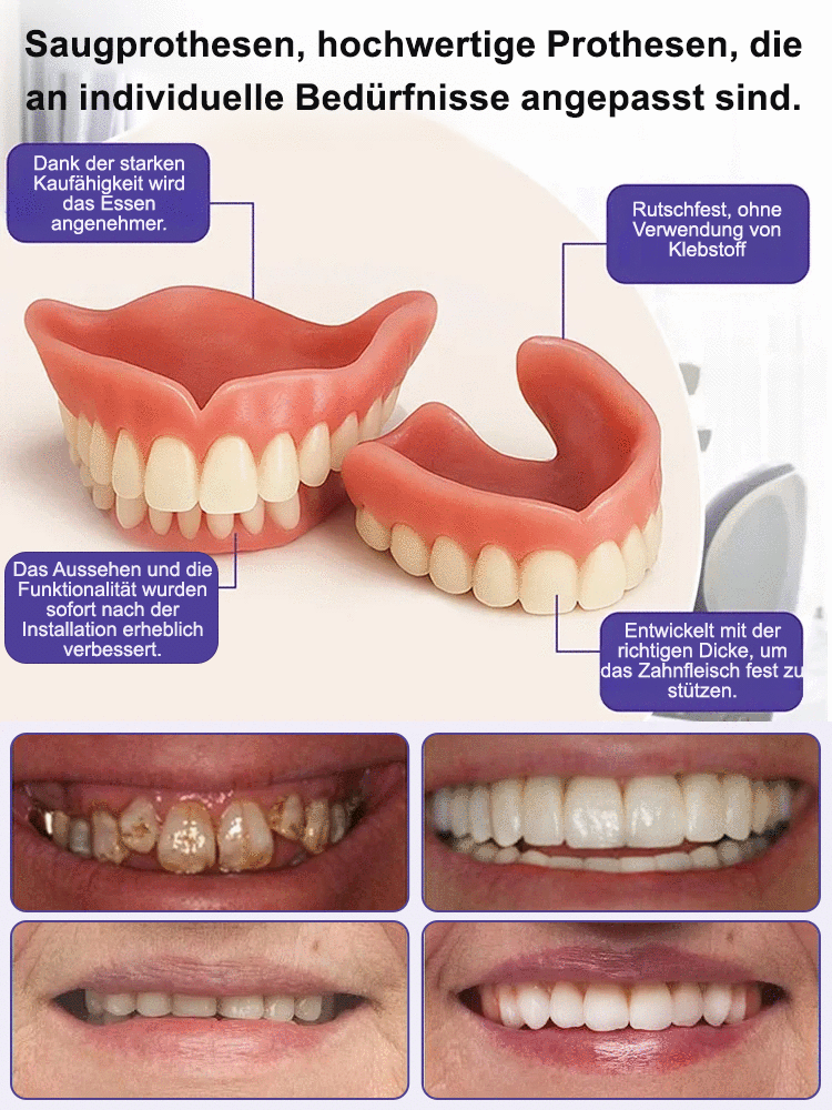 【Zahnarztfrei】Aufhellende realistische Zahnspange