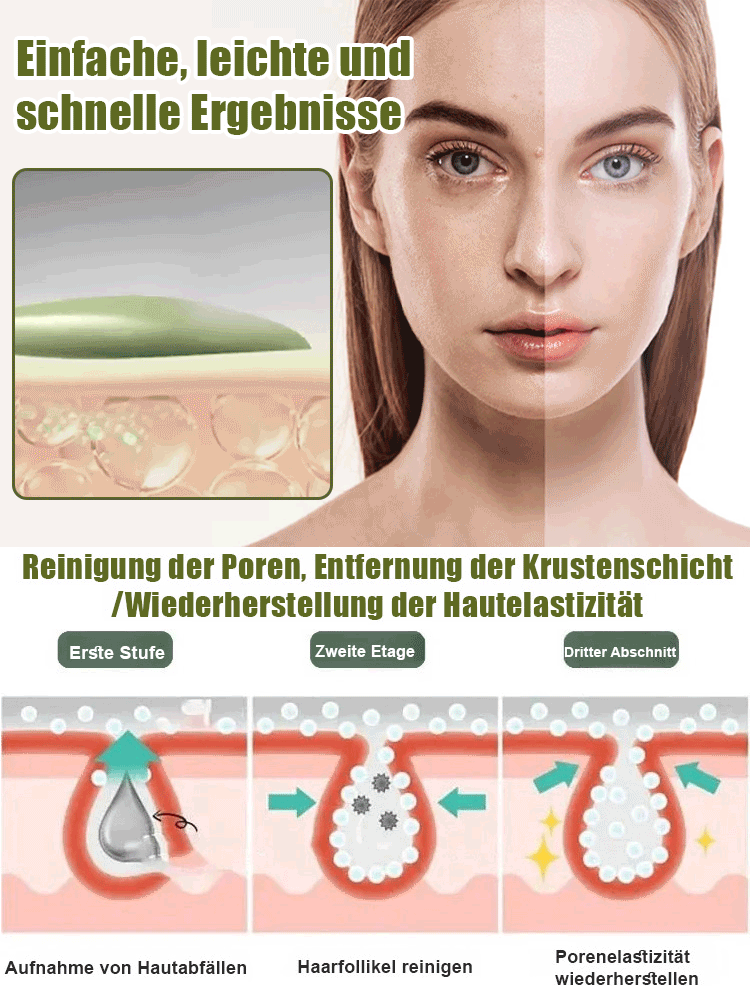 Mitesser-Entferner Porenreinigungsstreifen