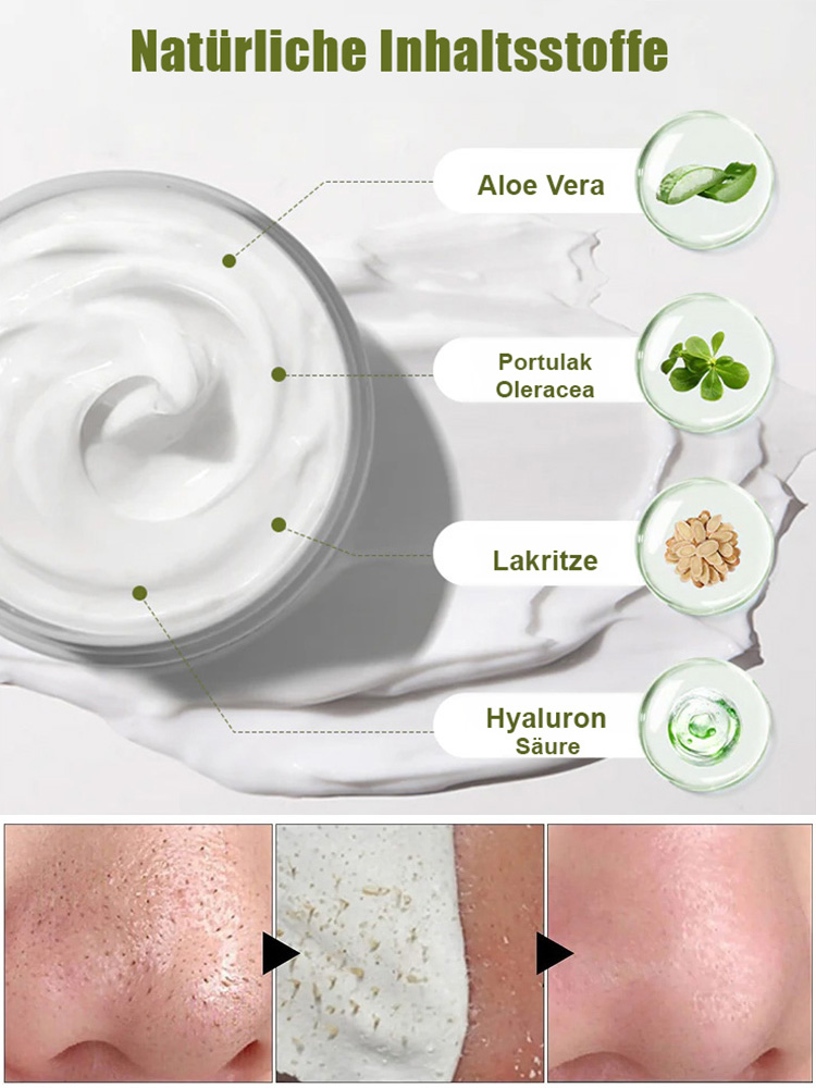 Mitesser-Entferner Porenreinigungsstreifen