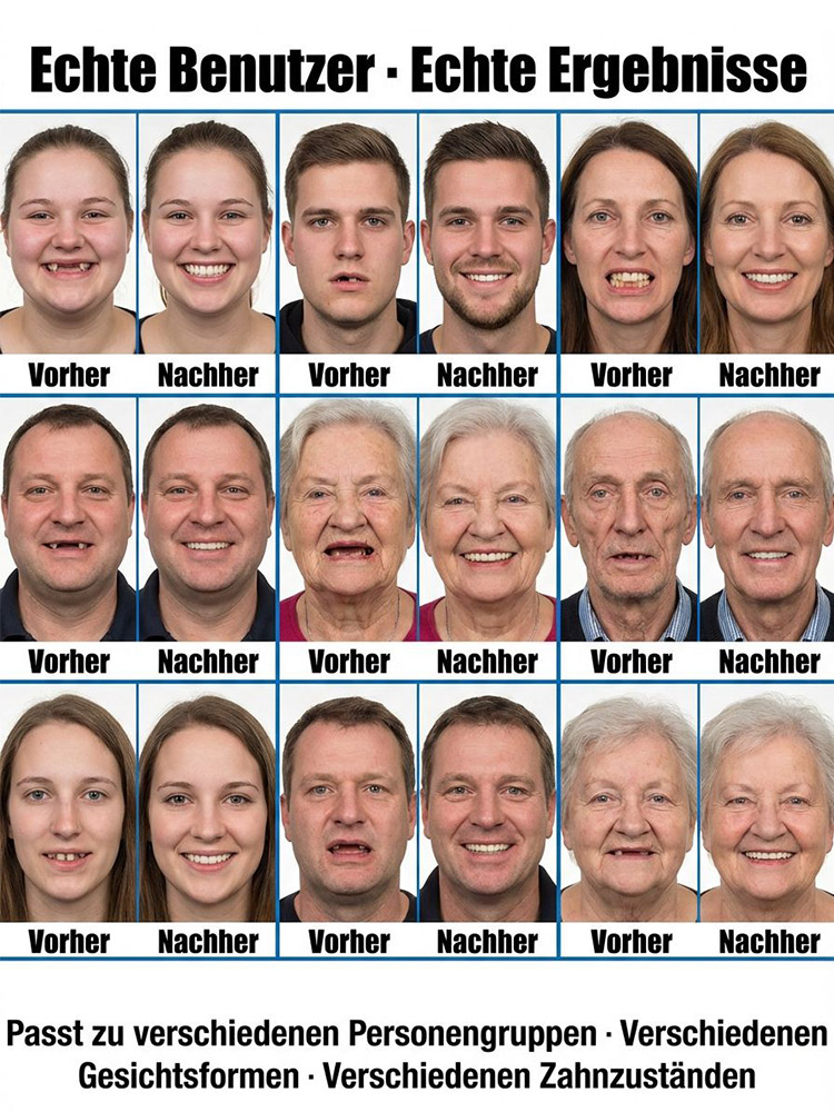 【Perfekte Anpassung an die Gesichtsform】Selbstanpassende Vollabdeckung mit Zahnspange