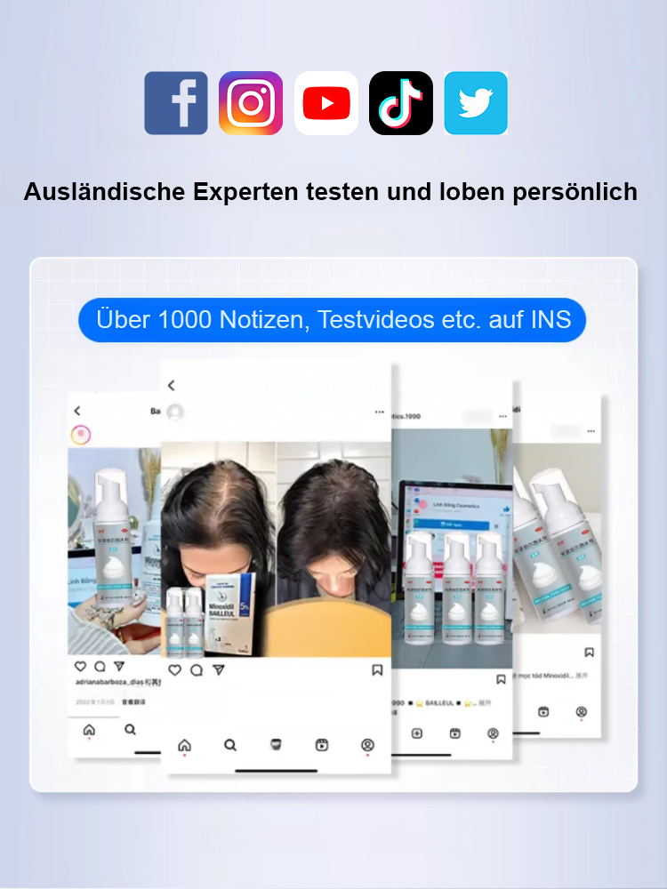 5% Minoxidil-Schaum für optimale Konzentration, sichtbare Wirkung innerhalb einer Woche 💪, das beste Mittel gegen Haarausfall im Herbst und Winter 🍂❄️