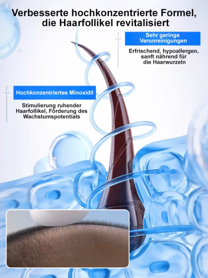 5% Minoxidil-Schaum für optimale Konzentration, sichtbare Wirkung innerhalb einer Woche 💪, das beste Mittel gegen Haarausfall im Herbst und Winter 🍂❄️