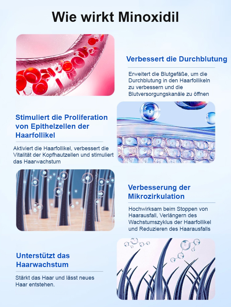 5% Minoxidil-Schaum für optimale Konzentration, sichtbare Wirkung innerhalb einer Woche 💪, das beste Mittel gegen Haarausfall im Herbst und Winter 🍂❄️
