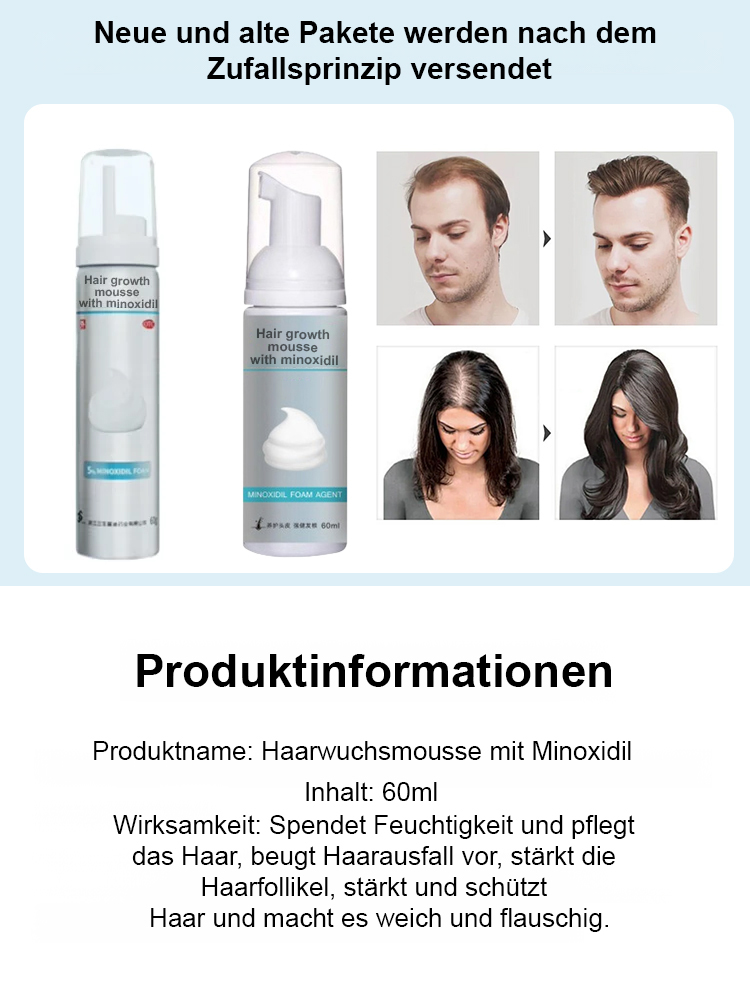 5% Minoxidil-Schaum für optimale Konzentration, sichtbare Wirkung innerhalb einer Woche 💪, das beste Mittel gegen Haarausfall im Herbst und Winter 🍂❄️