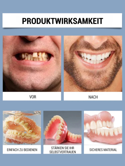 Perfekte Zahnblende für Zuhause 🦷 Ohne Zahnarzt, Kein Kleber, Durch Wärme anpassbar, Natürliches Aussehen ✨