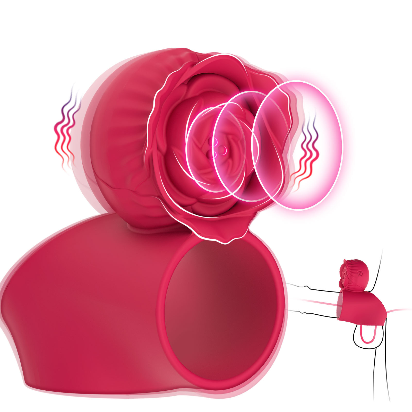 irritable ring