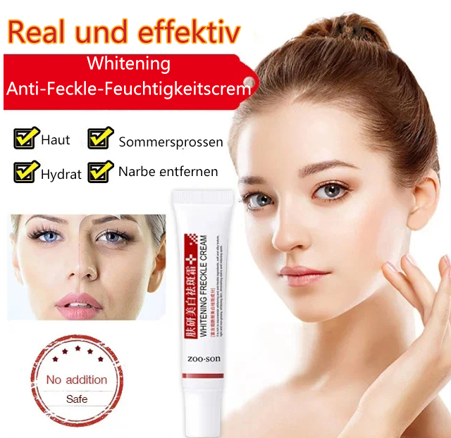 Von professionellen Ärzten empfohlene Aufhellungs- und Anti-Sommersprossen-Creme