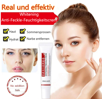Von professionellen Ärzten empfohlene Aufhellungs- und Anti-Sommersprossen-Creme