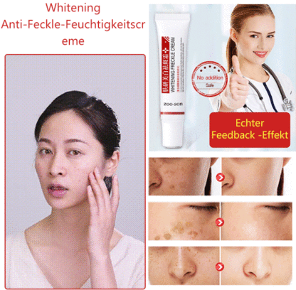Von professionellen Ärzten empfohlene Aufhellungs- und Anti-Sommersprossen-Creme