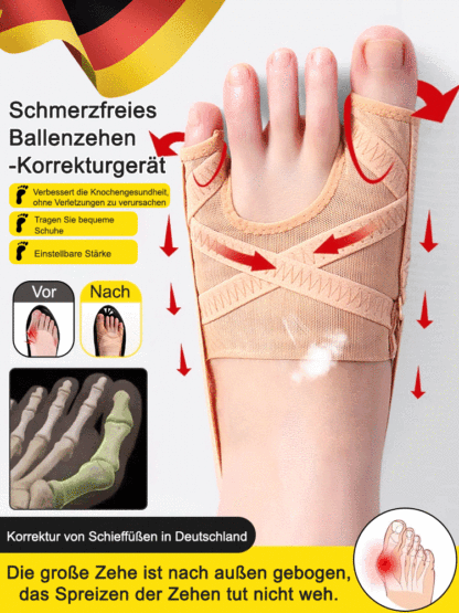 Verabschieden Sie sich in 7 Tagen von Hallux Valgus und Wadenvalgus, 0 negative Bewertungen
