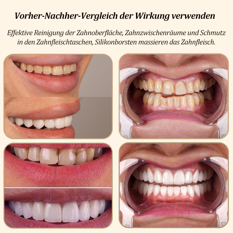 [Von Zahnärzten entwickelt] 10-Sekunden-vollautomatische, faule U-förmige elektrische Zahnbürste