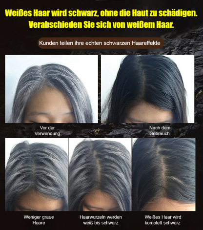 Sehen Sie die Veränderung in 7 Tagen, eine Flasche heilt graue Haare und Haarausfall vollständig