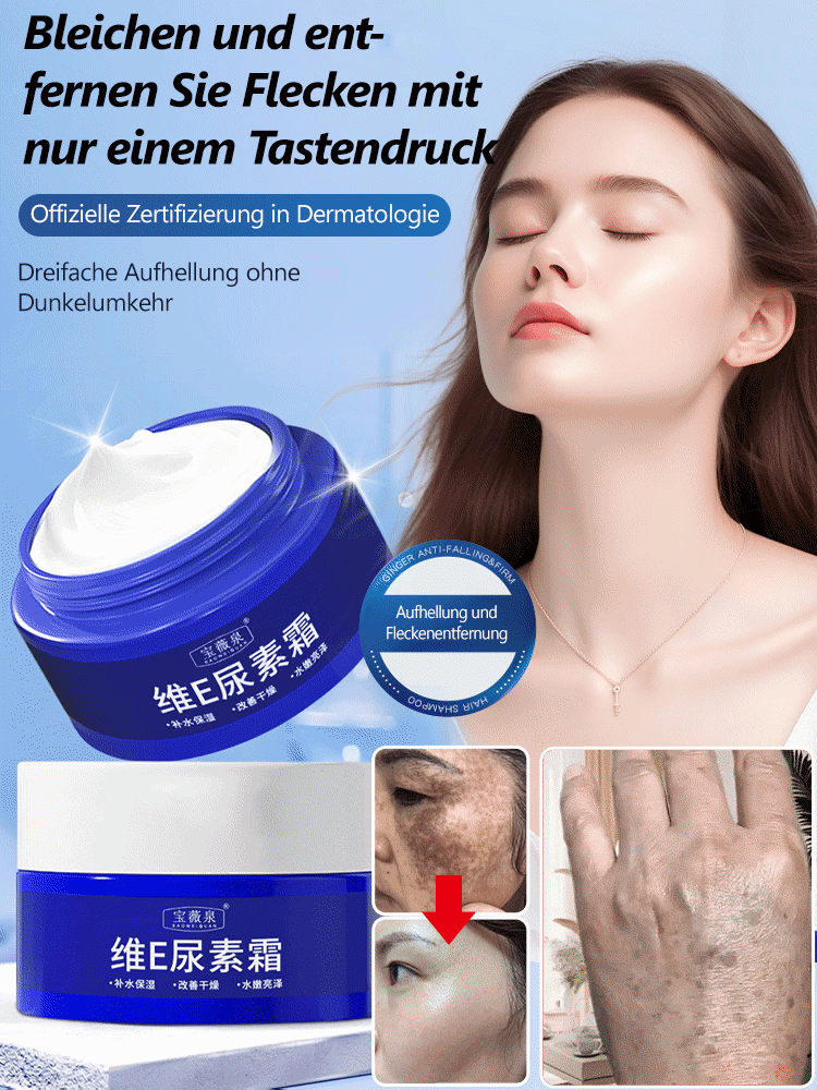 【Alte Flecken, Gelbe Flecken, alles weg】Fleckenaufhellende Ureacreme