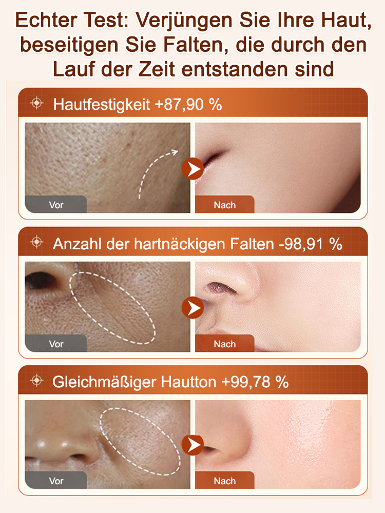 [Falten in Sekunden entfernen] Ecdoin Anti-Aging-Essenz
