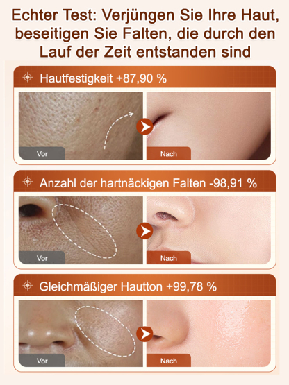 [Falten in Sekunden entfernen] Ecdoin Anti-Aging-Essenz