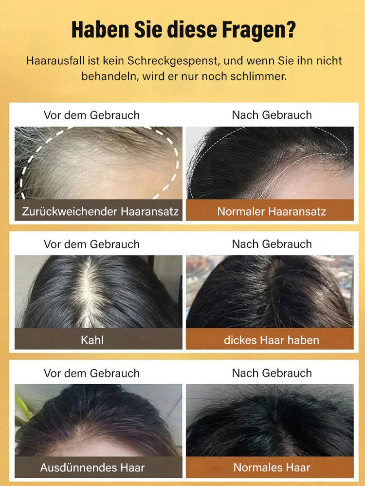 Das beste Shampoo für Menschen mit Haarausfall, Originalprodukt garantiert