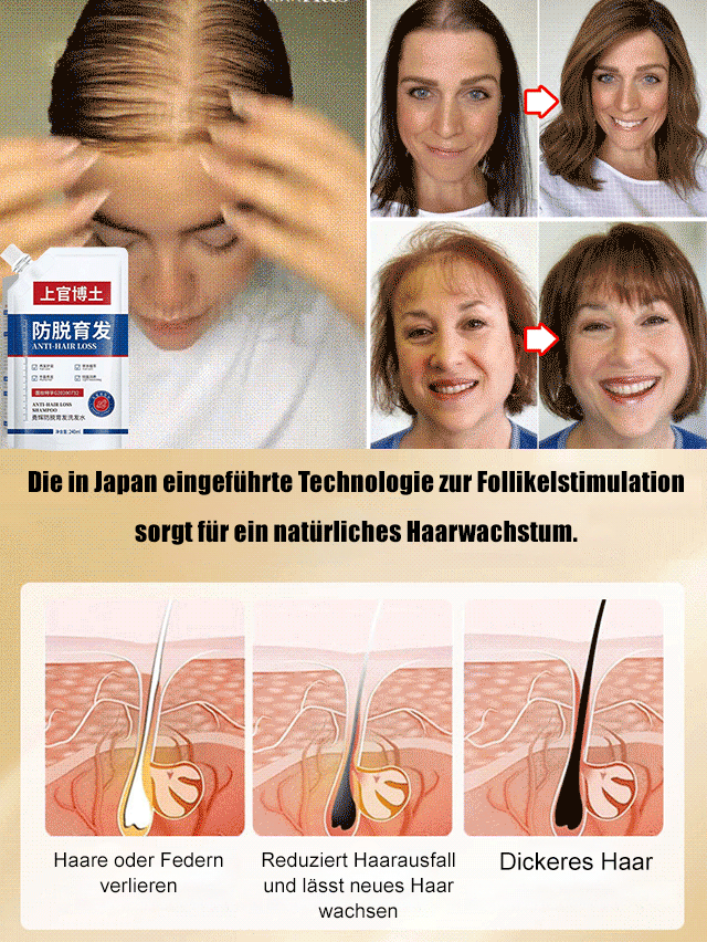 Das beste Shampoo für Menschen mit Haarausfall, Originalprodukt garantiert
