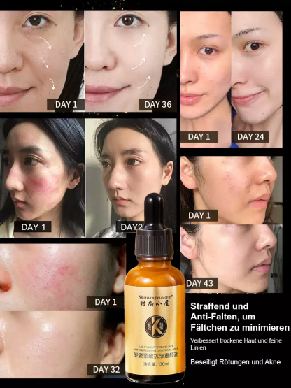 【Zürück ins Jahr 20】Faltenreduzierendes und Straffendes Serum