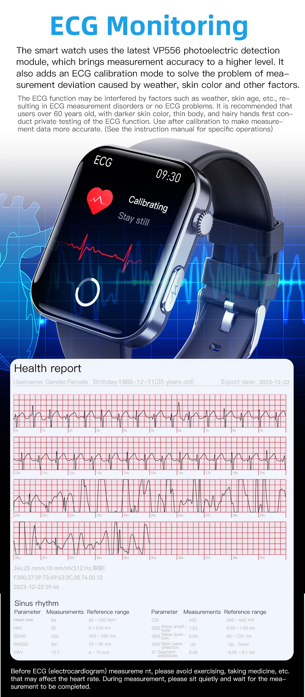 Hot F300 Bracelet ECG PPG Hrv Blood Oxygen Body Temperature Heart Monitor Smart Watch