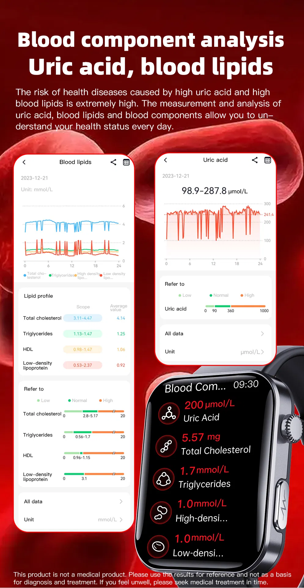 Hot F300 Bracelet ECG PPG Hrv Blood Oxygen Body Temperature Heart Monitor Smart Watch