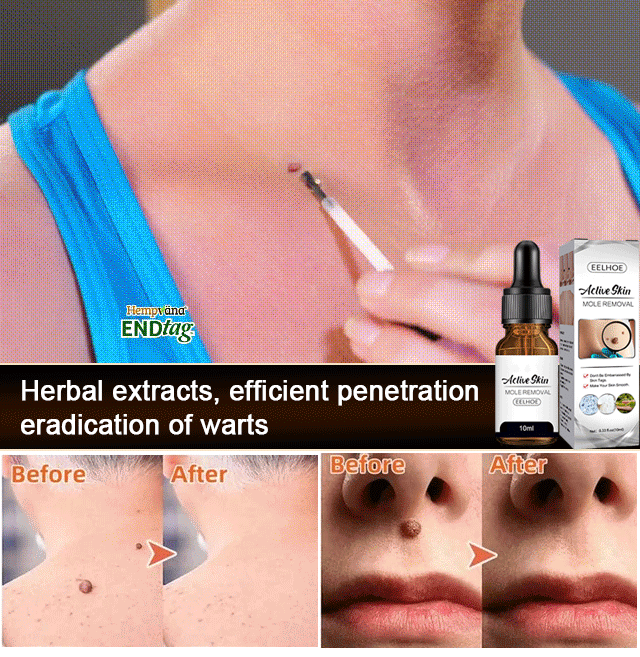 [Buy 1 Free 1]Spots and moles removal essence