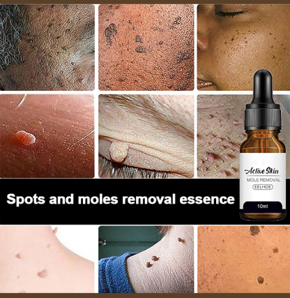 [Buy 1 Free 1]Spots and moles removal essence