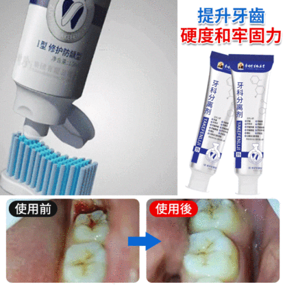 【改善牙齦腫痛、敏感、出血、牙齒鬆動問題】牙齒分離劑牙膏