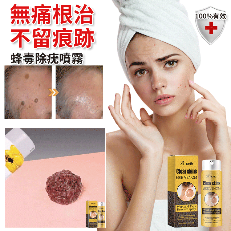 蜂毒克疣護理噴霧