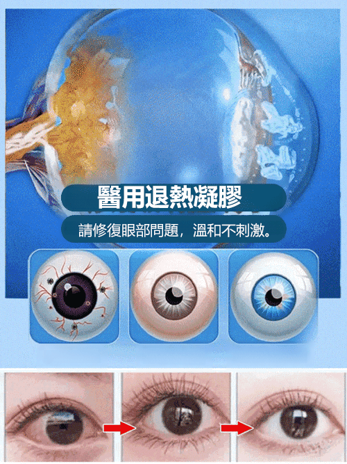 貞大夫醫用眼睛退燒凝膠