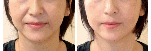 02ef94ca7f1a4d5636b26496c5d763e7.gif