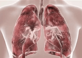 Honeycam 2025-12-04 17-30-27.gif