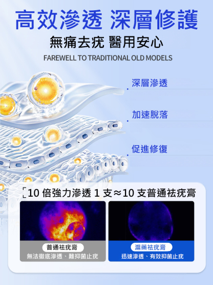 【除疣一抹靈】醫用退熱凝膠疣清寧！祛疣率高達99.99%，自然無痛脫落不留疤！