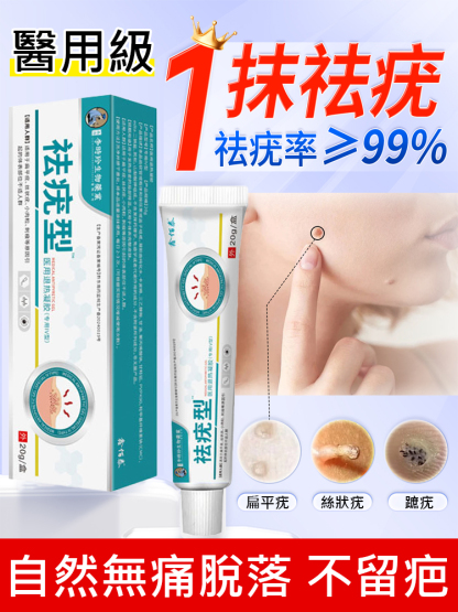 【除疣一抹靈】醫用退熱凝膠疣清寧！祛疣率高達99.99%，自然無痛脫落不留疤！