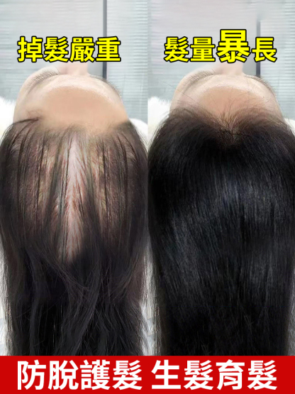 7天速生濃密防脫洗髮膏