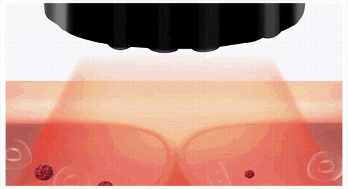 1 (6).gif