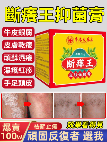 【爆賣100W+】斷癢王抑菌膏