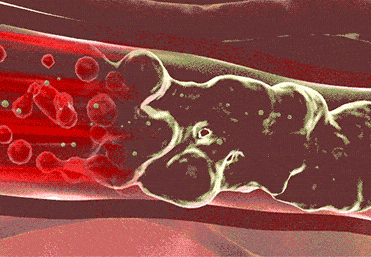 ad3aaca93707b3080606439ca34d459b.gif